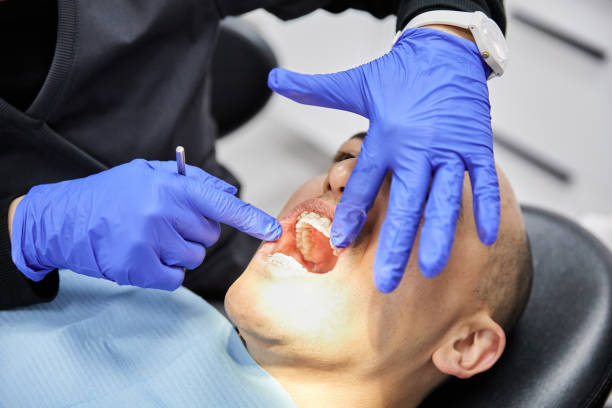 Dentist for Dental Trauma in MD